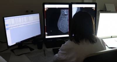 Investigadora estudiando la imagen de una mamografía 3D