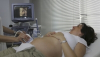 VÍDEO | La tasa de éxito del parto vaginal tras cesárea disminuyó durante los primeros meses de la pandemia